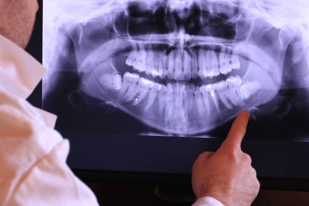 Best Pediatric Emergency Dentist in Robersonville, NC