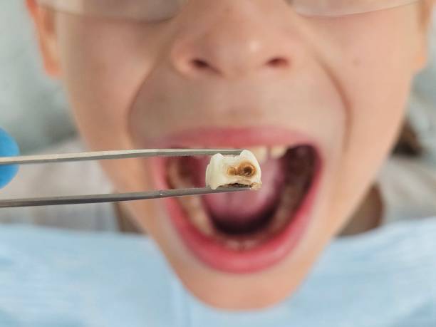 Best 24-Hour Emergency Dentist in Robersonville, NC